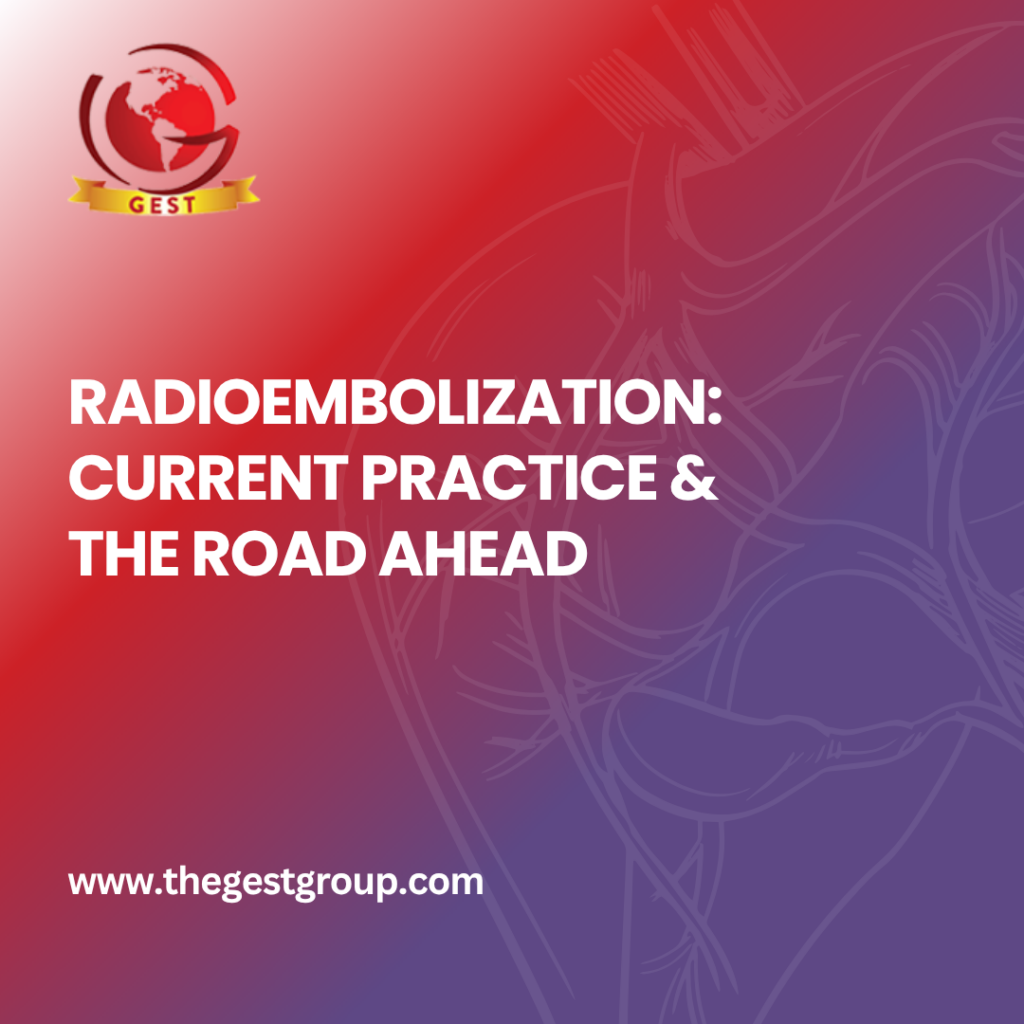 Radioembolization